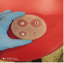 Figure 1. Medical ointment cream preparation from nano material ZnO/SiO2, and inhibiting microbial growth of the ointment cream on E.Coli microbial.