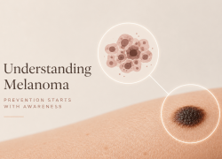 Everyday Lifestyle Factors that May Influence Melanoma Risk